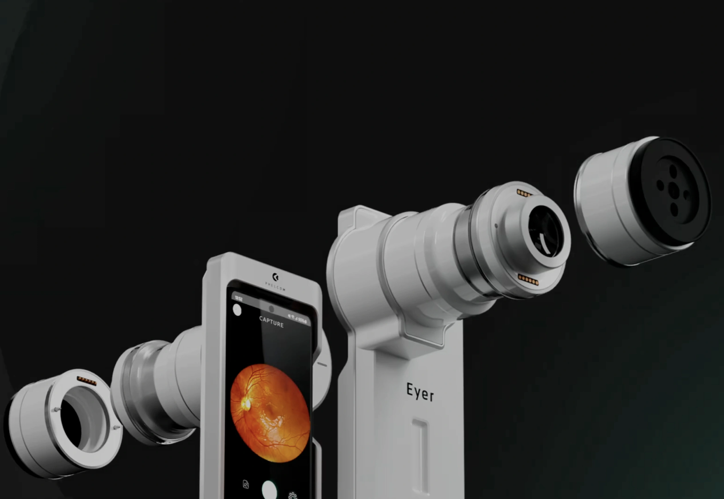 Phelcom Eyer | Utrera Oftalmólogo